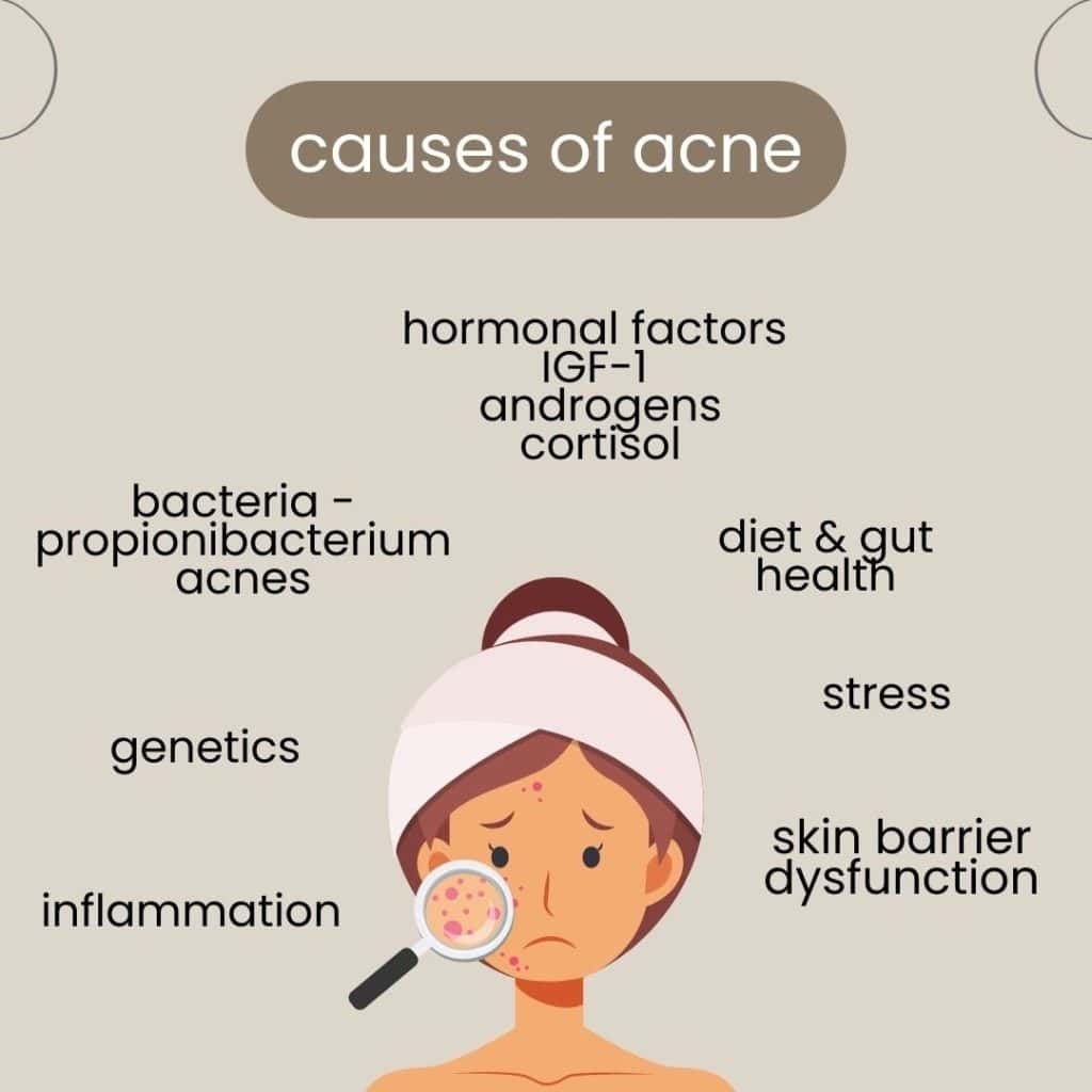 Clear illustration of acne causes including hormones, bacteria, diet, stress, genetics, inflammation, and skin barrier dysfunction for skin health improvement.