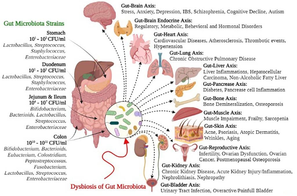 Dysbiosis of gut microbiota affecting gut health and its connection to various organs and diseases.