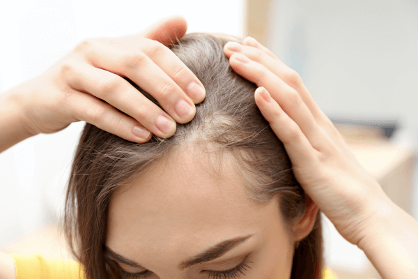 Hair Loss Naturopath Brisbane